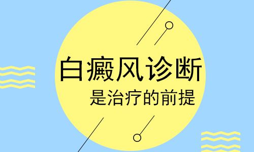 u=3588093950,2689925530&fm=11&gp=0.jpg