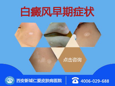 1636445B1-0.jpg